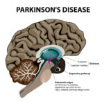 New drugs for Parkinson’s disease